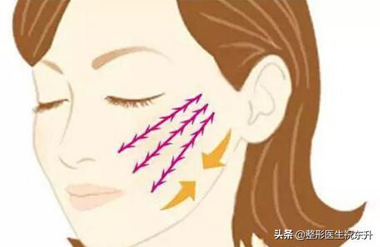 关于介绍面部线雕的视频,面部线雕的骗局