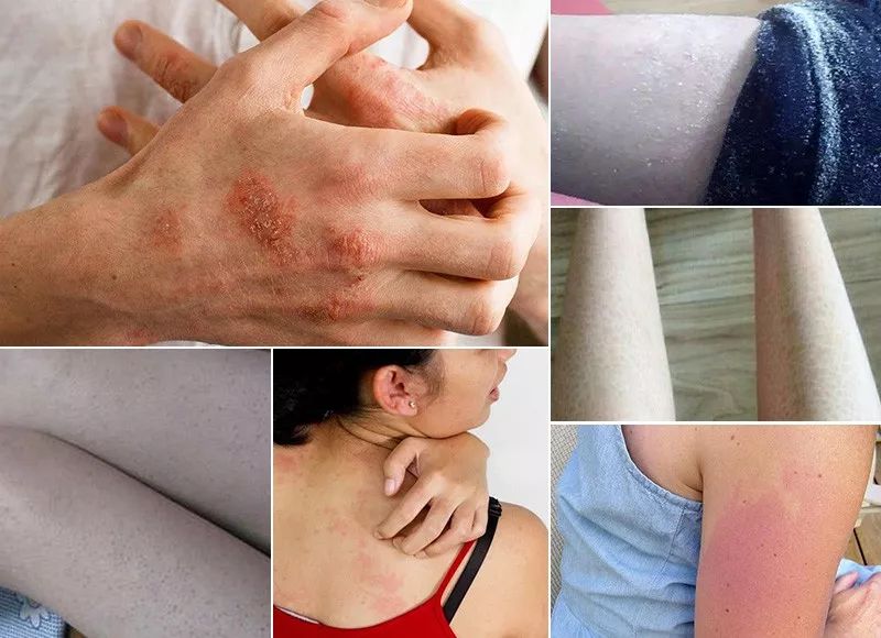 雅顿身体乳｜滋润保湿，持久留香，一大瓶性价比高