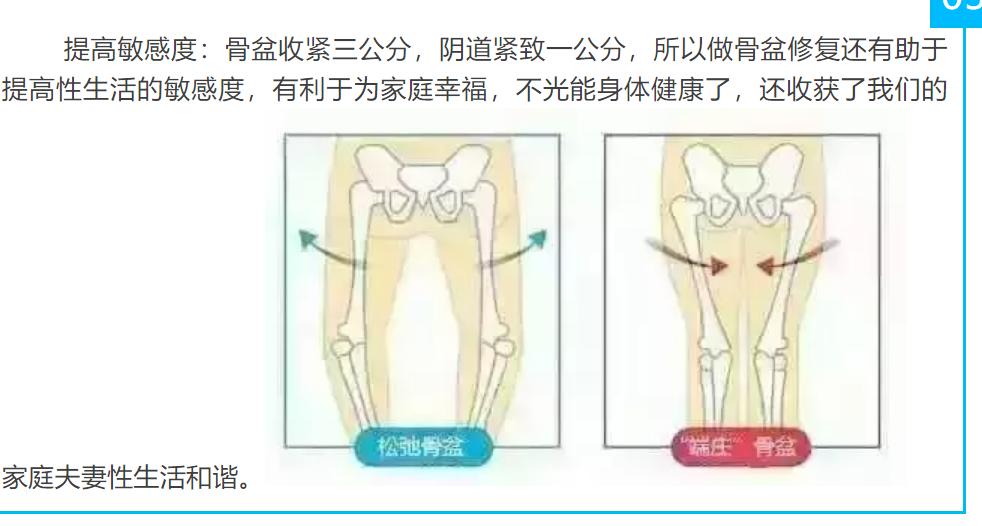最全产后骨盆修复,流行产后骨盆修复