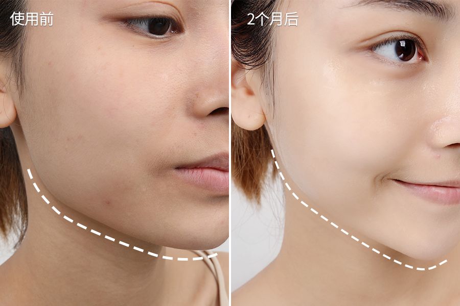 琚佸濮楁帹鑽愯憽钀勭苯鎶よ偆,琚佸濮楄憽钀勭苯绮惧崕