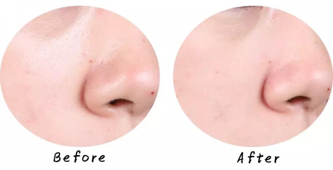 swisse麦卢卡蜂蜜排毒清洁面膜,超温和清洁面膜推荐哪个