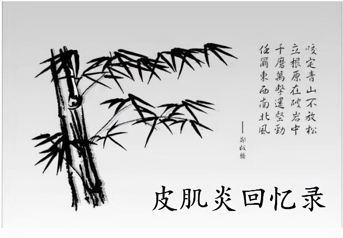 皮肌炎康复历程,皮肌炎治疗日记