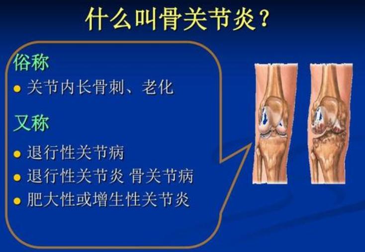 “骨头老了”怎么办？要补钙吗？医生说：有些需要补，有些不需要