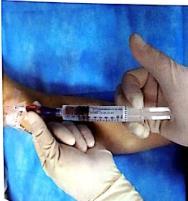 PICC冲封管不到位？来看看问题出在哪里吧