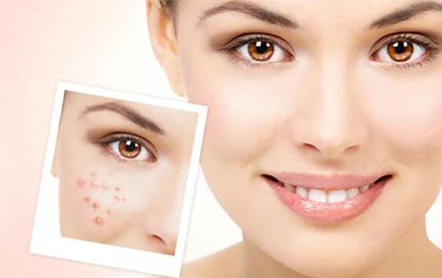 屈臣氏linefriends打折,屈臣氏碧尔缇希为什么打折