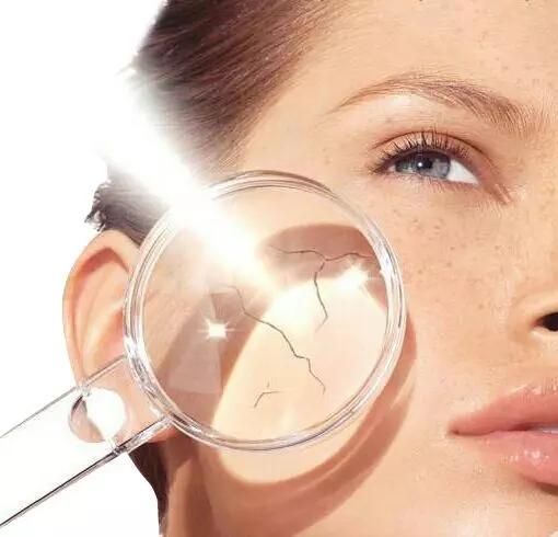 脸被太阳晒伤了能用维e吗,脸被太阳晒伤用什么药膏