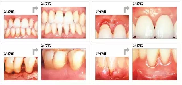 helen鐗欑,Helen榻跨涓績