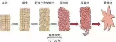 癌前病变应怎样治疗,8种常见的癌前病变及应对策略