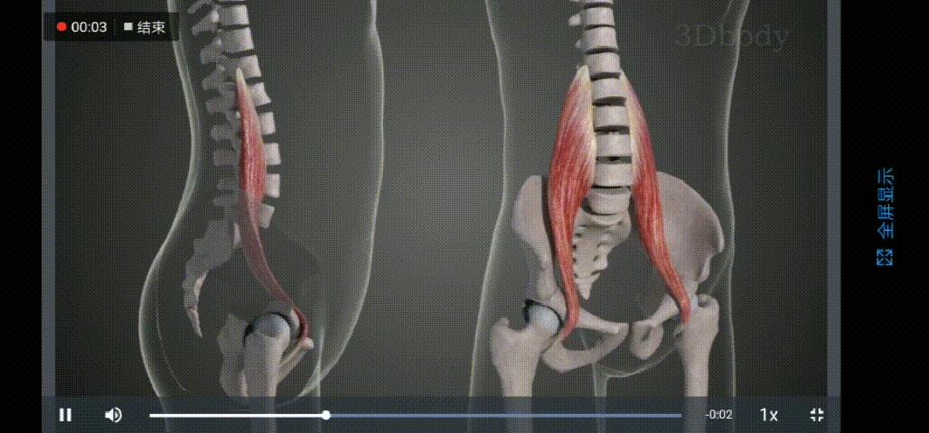 你以为你是翘臀其实是骨盆前倾,你以为的翘臀有可能是骨盆前倾