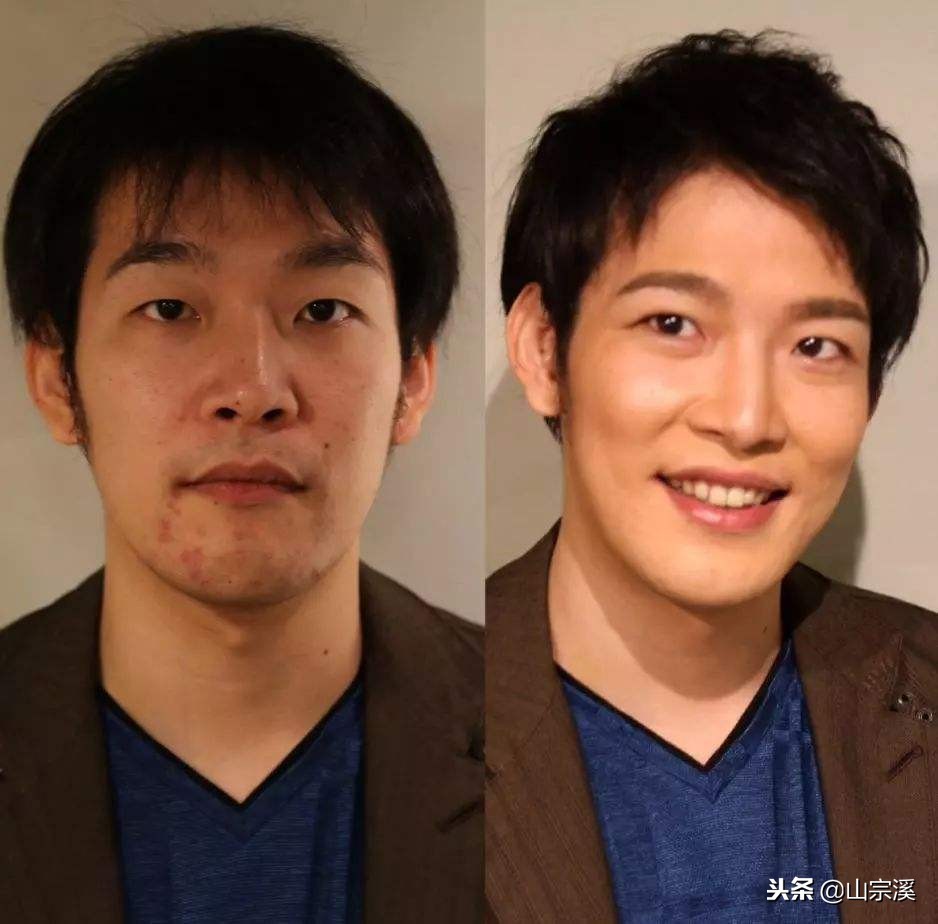 反复痘痘用什么祛痘产品好,祛痘全攻略脸上痘痘真的干净了