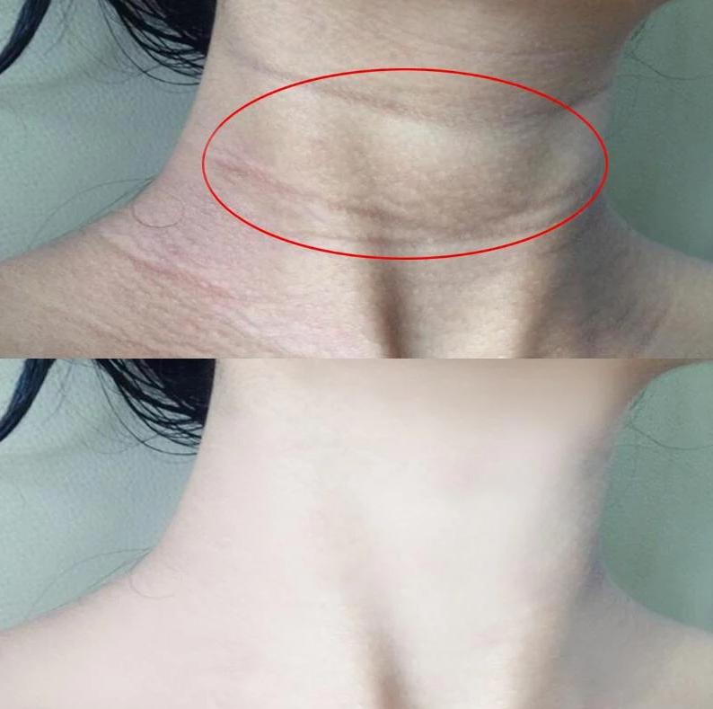 女人眉间有三条线,女人额头有三道杠说明什么