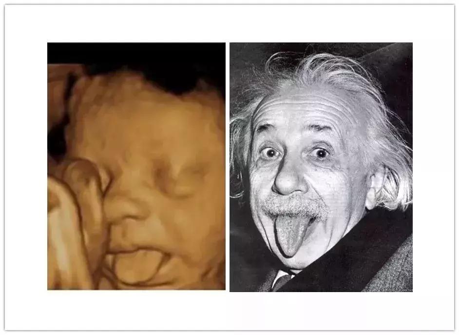 胎儿在妈妈肚子里干什么图片,胎儿在妈妈肚子里的位置变化