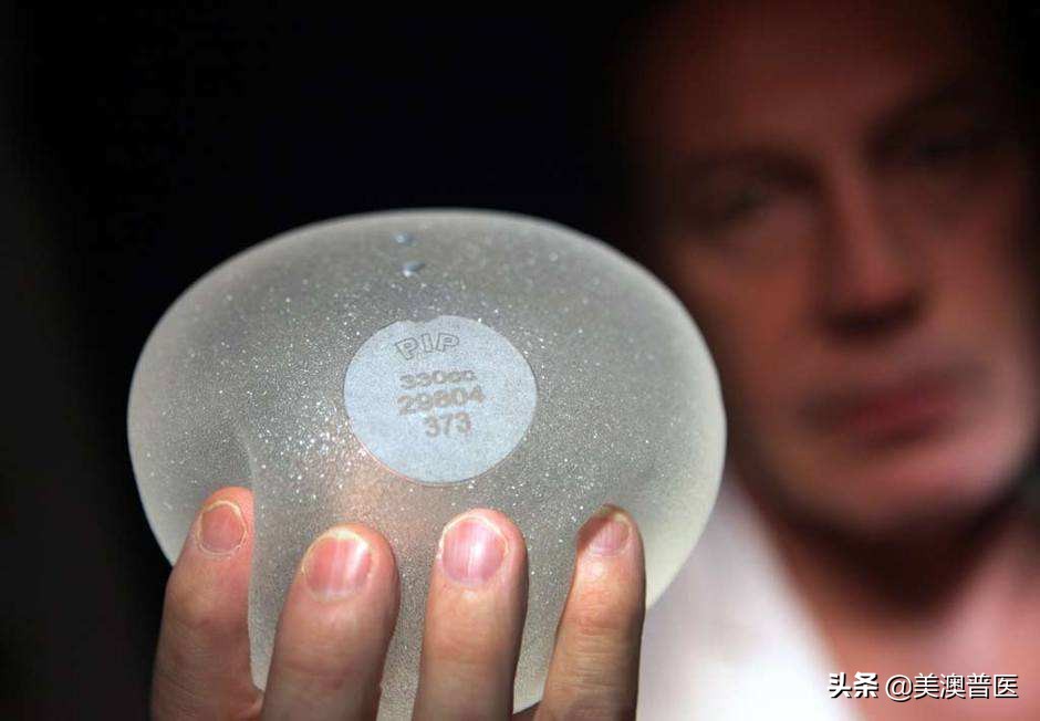 隆胸填充物被爆致癌，丰胸请谨慎