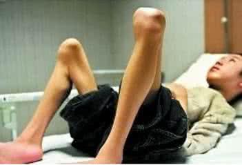 肾不肾虚有什么症状,肾不肾虚看中医吗