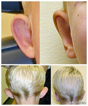 小孩的耳朵怎么护理,宝宝耳朵有异物医生怎么洗