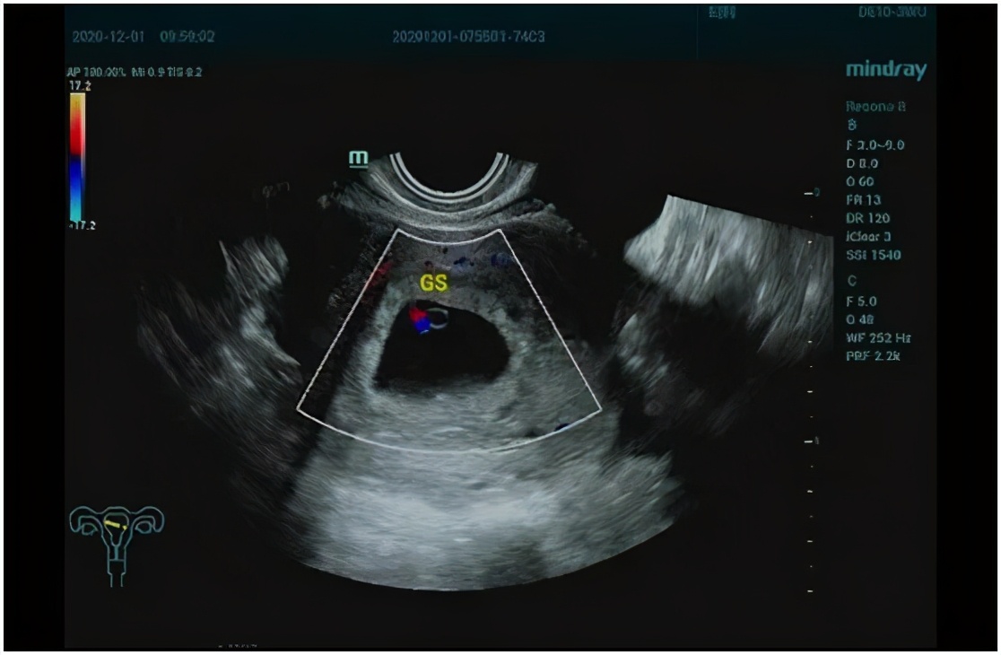 雄风再起全部视频,雄风再起完整版原唱