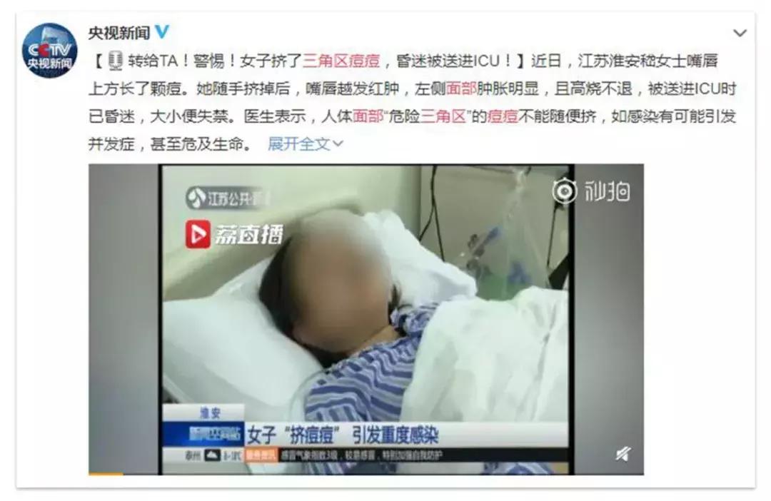 痘痘不小心破了怎么避免留坑,三角区的痘痘千万不要碰