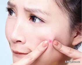 下巴爱长脓包痘痘是什么原因,下巴爱长白头粉刺