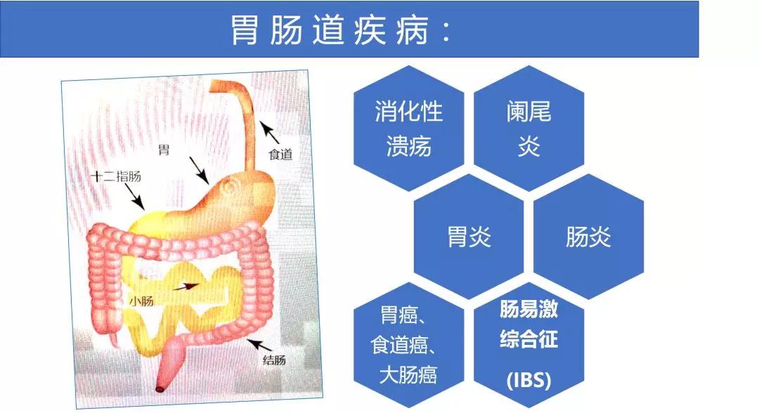 ibs肠易激综合征是浅表性胃炎吗,ibs肠易激综合征
