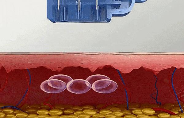 让你80岁都不长皱纹的方法,30-40岁抗皱纹衰老小妙招