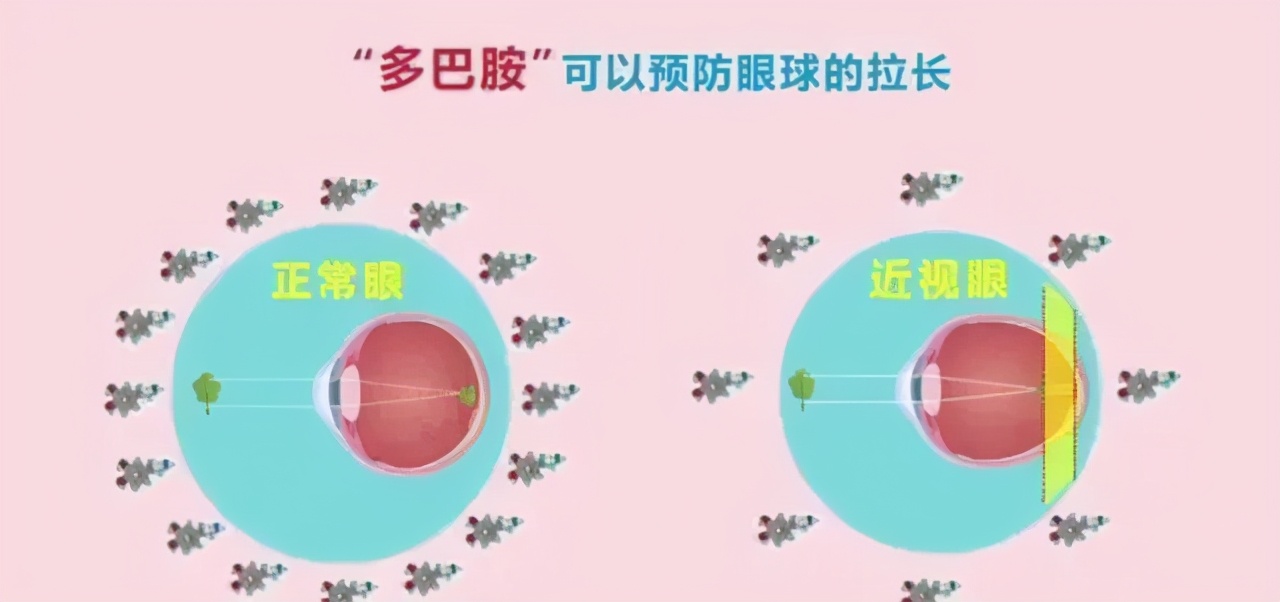 除了ok镜还有什么镜可以延缓近视,哺光仪和阿托品控制近视哪个好