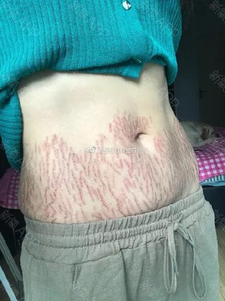 杨丽萍为什么不能生育,杨丽萍回应不生孩子争议