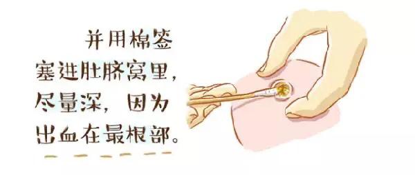 关于宝宝健康的知识,宝宝出生第一天脐带怎么护理