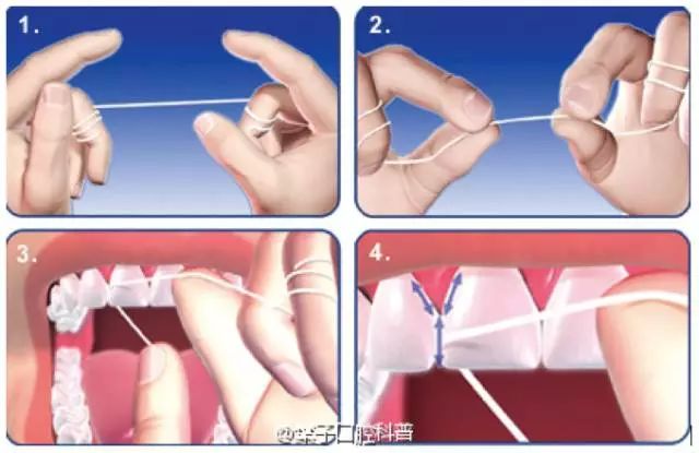 牙齿缺失后不镶牙有啥危害,牙齿缺失后不补有什么危害