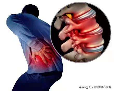腰疼脊柱侧弯是什么样,腰痛引起的脊柱侧弯原因
