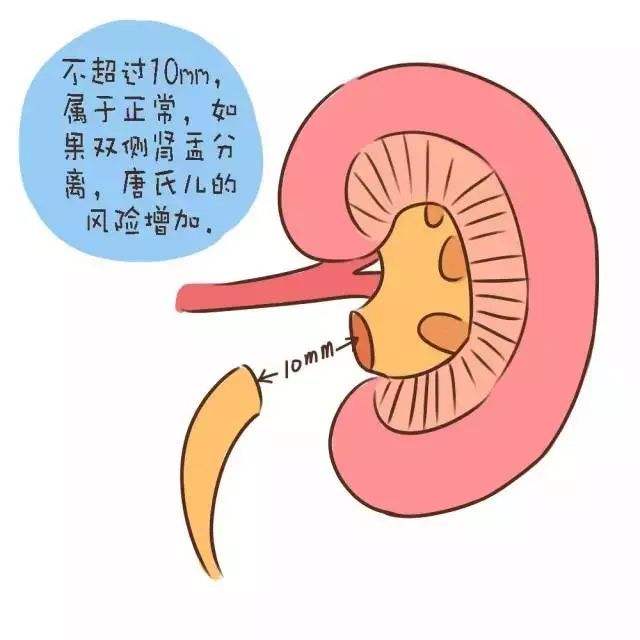 大排畸可以看出胎儿发育情况吗,胎儿小排畸结果数据怎么看