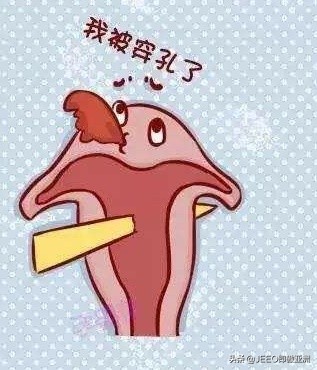 告诉你不知道的上环常识,关于上环的那些事科普