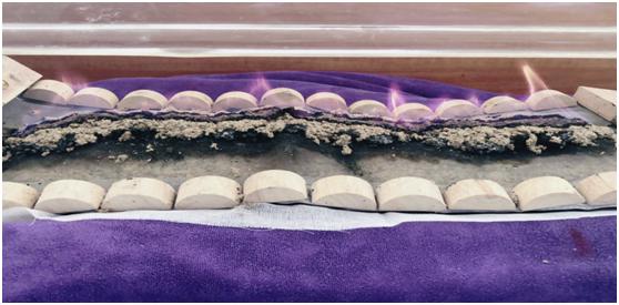 妇科炎症有积液用吃药不,盆腔积液盆腔炎最简单的自愈方法