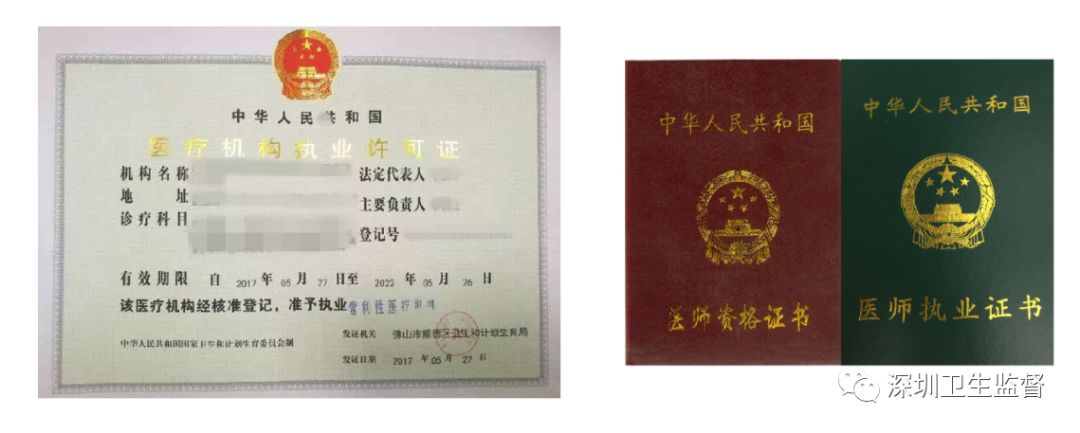 脱毛激光,脱毛各种方式比较