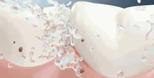 牙科牙齿美白全过程,牙齿黄又臭又烂牙怎么办