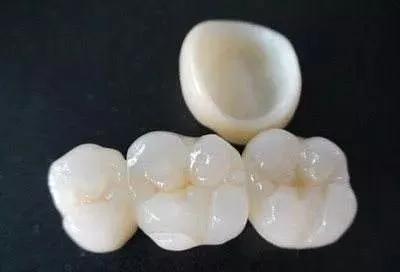 二氧化锆假牙可以做核磁吗,拿不掉的假牙可以做核磁共振么