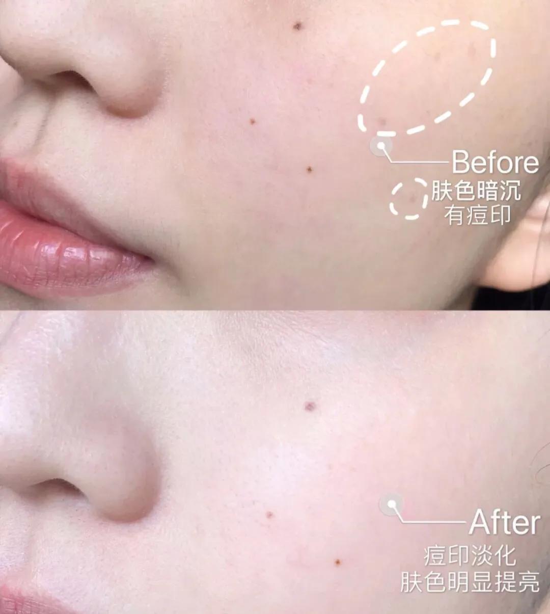 韩束新品升级在哪里,韩束亮肤型