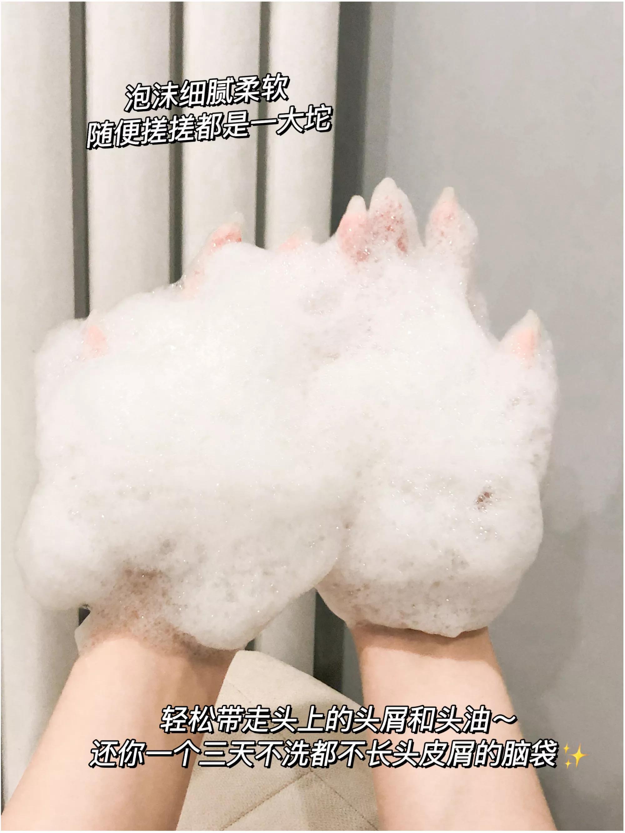 为什么从来没有头屑,你还在为头屑而烦恼吗