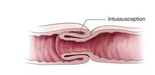 宝宝无缘无故哭闹是冷处理还是哄,宝宝晚上哭闹需不需要就医