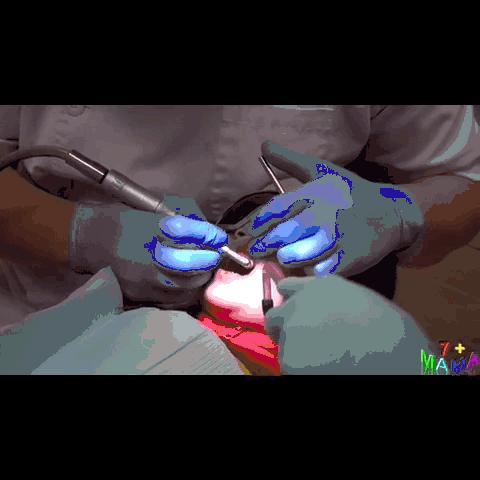 小朋友的牙菌斑要怎么去除,孩子有牙菌斑用什么刷牙