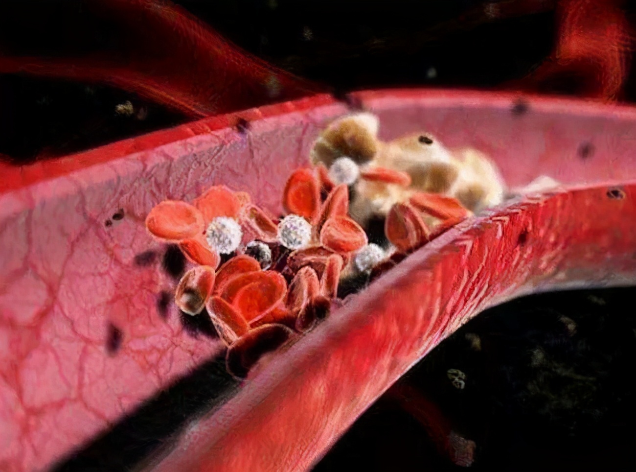 糖化血红蛋白高血糖正常啥原因,糖化血红蛋白高葡萄糖高怎么回事