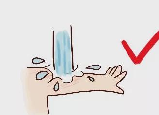 孩子被妈妈疏忽给烫伤,一岁女童掉进开水锅被烫伤