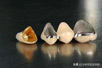 全瓷牙和烤瓷牙冠的区别,烤瓷牙和全瓷牙冠有什么区别