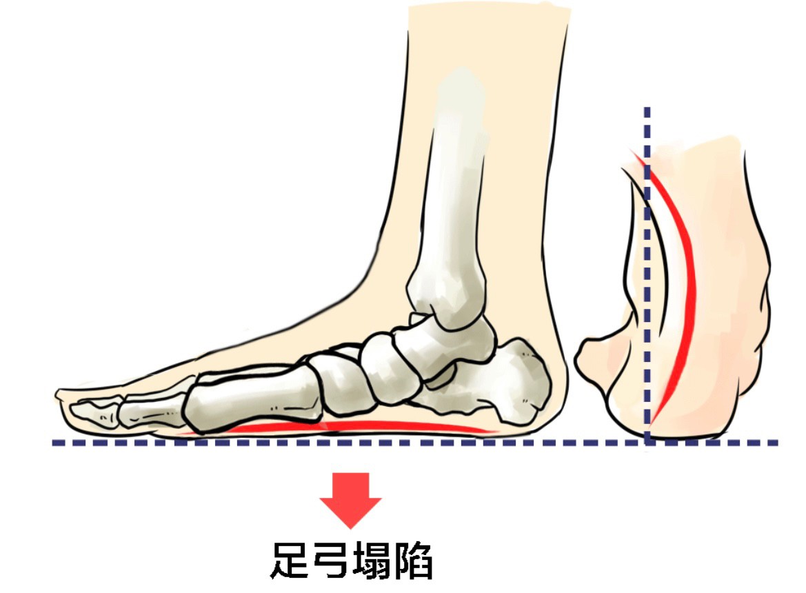 大姐骨折后康复视频,大姐骨折