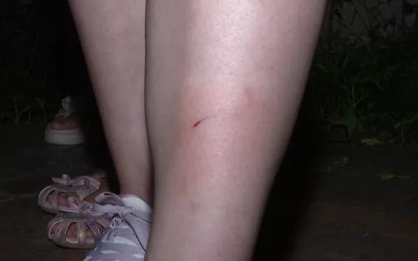 真是服了!高空抛物又来!贵州一女子小区散步,“钢琴”突然从天而降!结果......