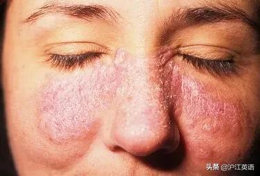 “欧美顶流”要退圈？因病发福被网暴致抑郁，换肾后惊艳归来