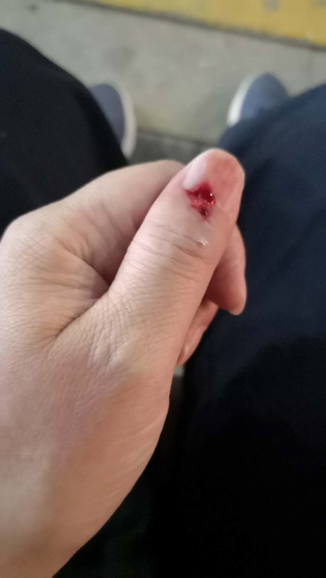 指甲一年换新几次？摔了一跤才得到了真实答案，纠正了想当然