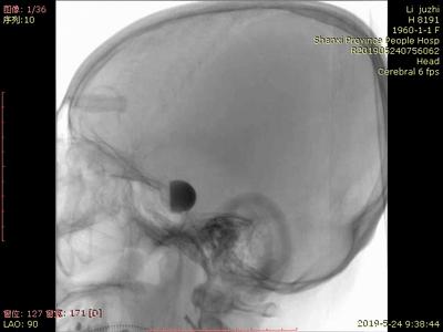 山西省人民医院任少华教授,山西省人民医院任少华