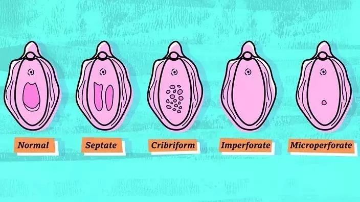 包丽死亡的原因,包丽死亡真实原因