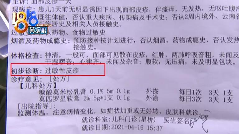 化妆品过敏小孩,孩子化妆过敏起疹子