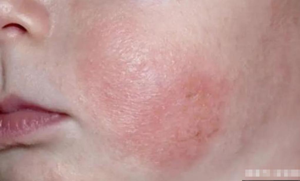 央视曝光纸巾比抹布还脏,这些“毒纸巾”比抹布还脏